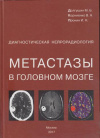 Купить книгу Долгушин, М.Б. - Метастазы в головном мозге. Диагностическая нейрорадиология